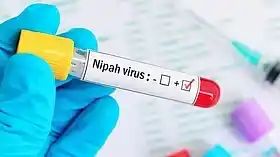 പെരിന്തല്‍മണ്ണയിലെ 15കാരിക്ക് നിപയില്ല; പരിശോധനാഫലം നെഗറ്റീവ്