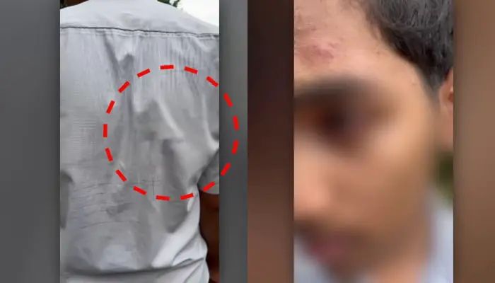 ഷര്‍ട്ടിന് പിന്നില്‍ കുത്തിവരച്ചത് ചോദ്യം ചെയ്ത വിദ്യാര്‍ത്ഥിക്ക് മര്‍ദ്ദനം, 5 പ്ലസ്ടു വിദ്യാര്‍ത്ഥികള്‍ക്കെതിരെ കേസ്