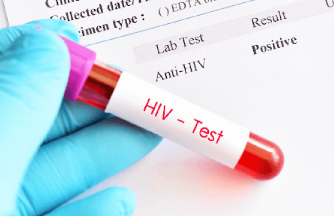 HIV ഫലങ്ങൾ തിരിമറി: 200 ദിനാർ കൈക്കൂലി നൽകിയ പ്രവാസിയുൾപ്പടെ ആരോഗ്യമന്ത്രാലയ ജീവക്കാർക്ക് 10 വർഷം കഠിനതടവ്