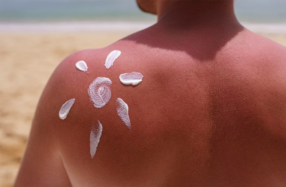 Experts Warn of Hidden Sunburn Dangers as UK Heatwave Triggers Amber Alert